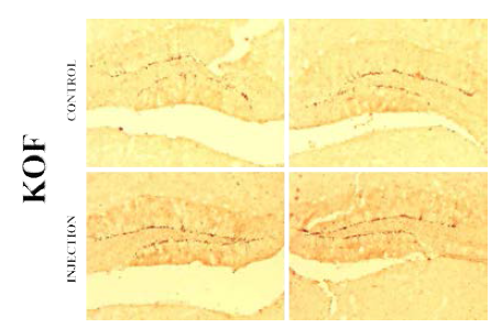 Klotho 주입한 12주령 KO female 마우스 뇌조직에서 DCX 발현_IHC