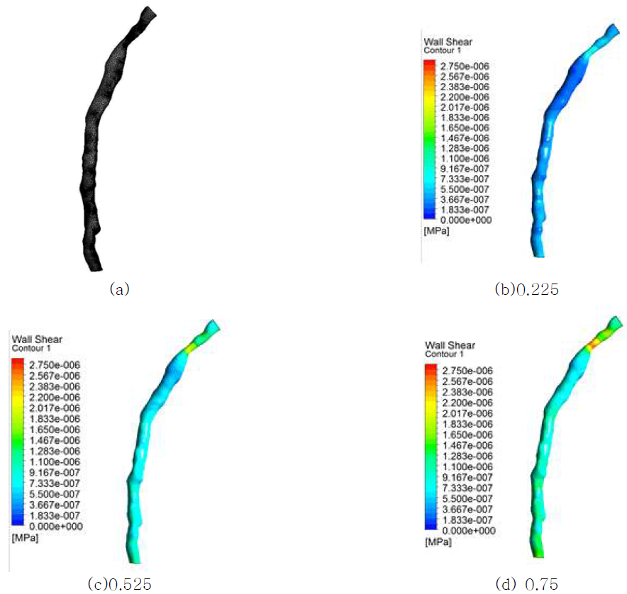 협착부를 포함하는 혈관 모델링의 벽전단응력 분포 (a) 혈관의 그리드 시스템, (b) t=0.225s, (c) t=0.525s (d) t=0.75s