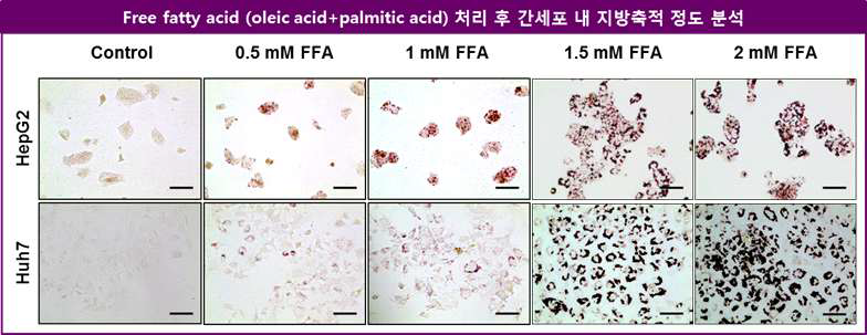 비알코올성 지방간 in vitro model 구축을 위한 FFA 처리 후 지방침착 분석