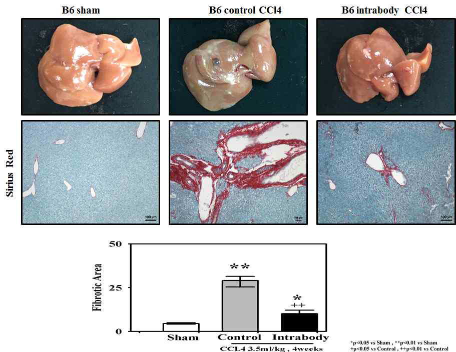 Intrabody에 의한 간섬유화 억제