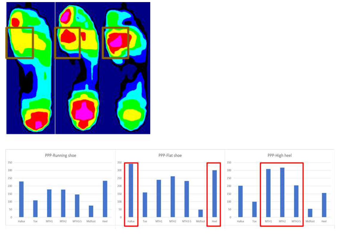 PEDAR system을 통해 얻은 신발에 따른 족저압 변화의 대표적 증례