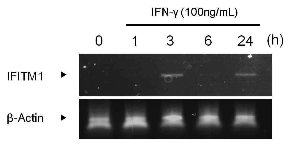 IFN-γ의 시간에 따른 중간엽 줄기세포에서의 IFITM1 유전자의 발현 (PCR)