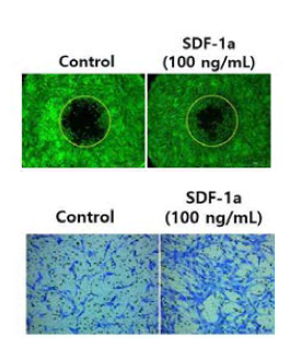 SDF-1a 처리에 따른 MSCs 의 migration 및 invasion 효과 평가