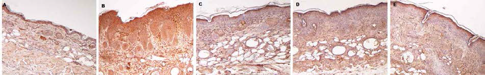 아토피피부염의 피부 조직 내 COX-2 발현량 비교(면역화학염색, X200). A. Negative control, B. Positive control; OX, C. OX+MβCD 5%, D. OX+EPS 5%, E. OX+CSO 5%)