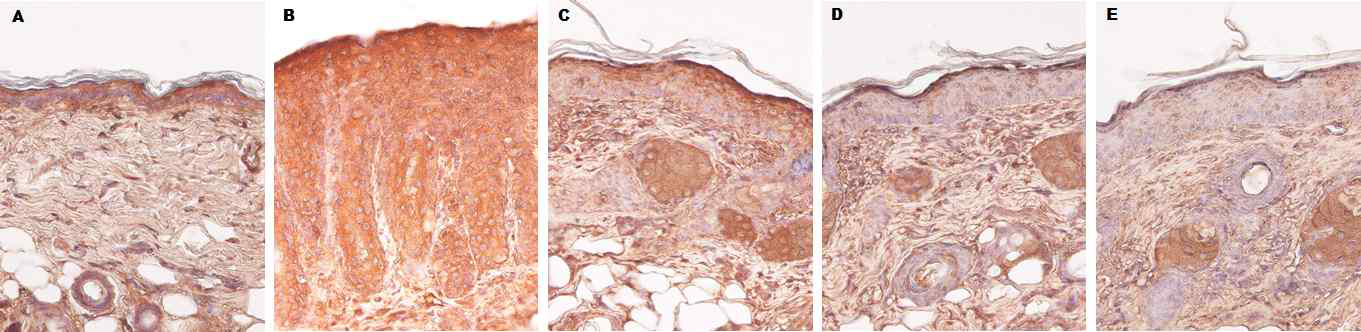 아토피피부염의 피부 조직 내 TSLP 발현량 비교(면역화학염색, X400). A. Negative control, B. Positive control; OX, C. OX+MβCD 5%, D. OX+EPS 5%, E. OX+CSO 5%)