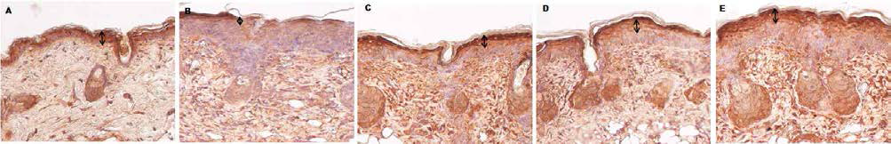 아토피피부염의 피부 조직 내 filaggrin 발현량 비교(면역화학염색, X400). A. Negative control, B. Positive control; OX, C. OX+MβCD 5%, D. OX+EPS 5%, E. OX+CSO 5%)