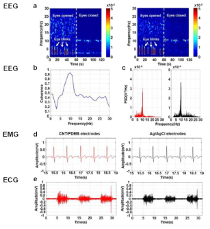 생체 신호 측정 및 결과: EEG, EMG 및 ECG