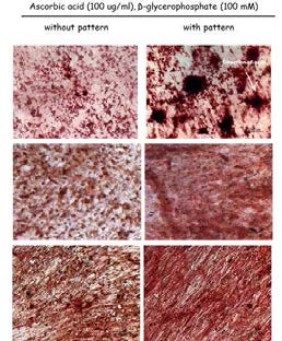 MC3T3 (상), Ad-MSC(중), PDLSC(하)의 조골 세포 부화 후 alizarin red 염색