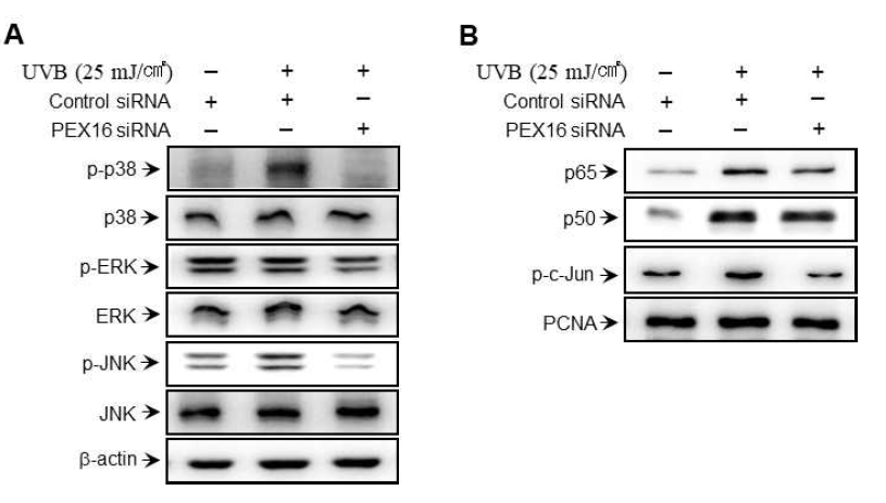 피부 섬유아세포에서 자외선에 의한 MAPK, NF-kB/AP-1 활성화에 대한 페록시좀 유전자 PEX16의 억제 효과 확인