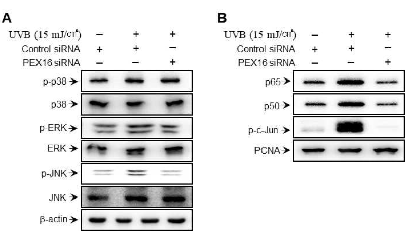 피부 각질세포에서 자외선에 의한 MAPK, NF-kB/AP-1 활성화에 대한 페록시좀 유전자 PEX16의 억제 효과 확인