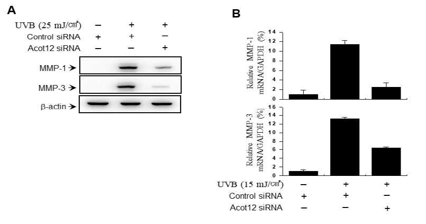 피부 섬유아세포에서 페록시좀 유전자 Acot12억제에 따른 자외선에 의한 MMP 발현 억제 효과 확인