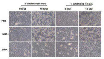 21RA 단클론 항체의 중화효과. 21RA 단클론 항체는 V.cholerae와 V. vulnificus의 독소 MARTXVc와 RtxA1에 의해서 야기 되는 Cell rounding을 억제함. PBS: buffer control, 14NS1: West Nile virus NS1 단클론 항체