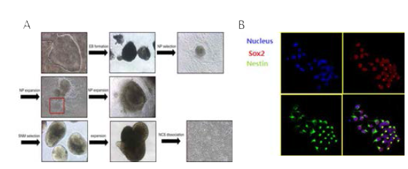 iPSCs로부터 신경줄기세포 제작 과정 및 Nestin과 Sox2 마커 발현 분석을 통한 신경줄기세포 확인