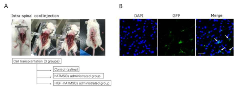 운동신경원병 마우스모델에 HGF-hATMSCs의 intra-spinal cord injection. A. HGF-hATMSCs의 intra-spinal cord injection을 통한 투여사진, B. 척수 내 HGF-hATMSCs의 생착능 확인