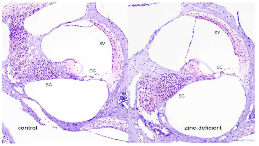 Effects of a zinc-deficient diet and noise exposure on structural changes in the cochlea of CBA mice (x 100). There was no apparent structural change in all groups. OC, organ of Corti; SG, spiral ganglion; SV, stria vascularis