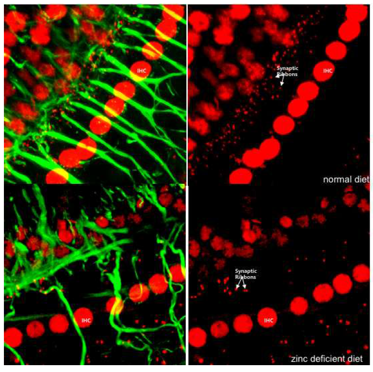 The differences of ribbon synapse in inner ear between two groups. The number of ribbon synapse was decreased in the mice of zinc-deficient diet for 8 weeks. IHC: inner hair cell