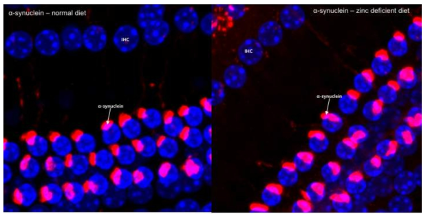 The alpha-synuclein was stained in the outer hair cell of inner ear. There was no difference of the positive staining in both groups (control and zinc-deficient diet). IHC: inner hair cell