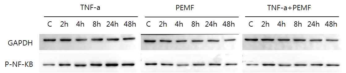 HaCaT 세포에서 PEMF에 의한 NF-kB 발현 영향 확인