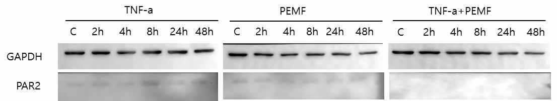 건선의 홍반성 염증물질의 단백질 발현에 미치는 PEMF의 영향 연구