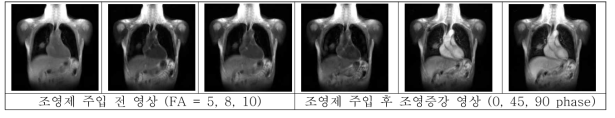 역동적 조영증강 자기공명영상의 프로토콜 정립