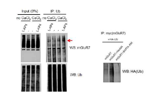 세포내 칼슘과 유비퀴틴화