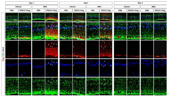 Prox1 재조합 단백질의 망막신경세포로의 침투능력 검증. ‘그림 141’에서 생산한 Prox1 재조합 단백질을 각각 MNU를 주사하여 광수용세포의 퇴화를 유도한 생쥐와 PBS를 주입한 생쥐의 안구에 주입하여 이들의 망막신경세포로의 침투능력을 검증하였음. Flag-antibody를 사용한 면역형 광염색법을 사용하여 Prox1 재조합 단백질의 망막내 존재여부를 확인하였을 때, 광수용세포의 퇴화를 유도한 생쥐 망막에서 더 많은 양의 Prox1 재조합 단백질이 관찰되었음. 특히 이들 Prox1 재조합 단백질의 대부분은 Sox2로 표지된 MG에 존재하고 있음을 확인함