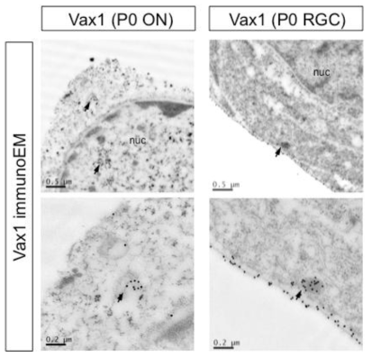 시신경 성상세포 전구세포 내 Vax1의 분포. 망막 신경 세포 외부에 분포하는 Vax1 단백질. Vax1 유전자를 발현하는 생후 시신경 (P0 ON)의 성상세포에서 Vax1은 주로 핵에서 DNA와 결합하여 있거나 세포질 내의 분비과립에 분포하고 있으나, Vax1을 발현하지 않으나 세포 내에 Vax1 단백질을 포함하는 것으로 본 연구팀에서 확인한 생후 망막 신경세포 (P0 RGC)에서는 Vax1 단백질이 주로 세포막 외부와 세포 endocytotic vesicle에 주로 분포하는 것으로 나타남