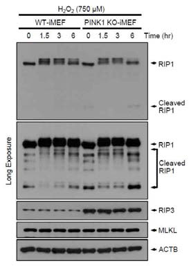 H2O2를 이용한 산화적 스트레스 하에서 necroptosis의 변화. 두 세포주에 750 uM H2O2를 0, 1.5, 3, 6시간 동안 처리한 후 RIP1, RIP3, MLKL 항체를 이용해 웨스턴 블럿을 수행함