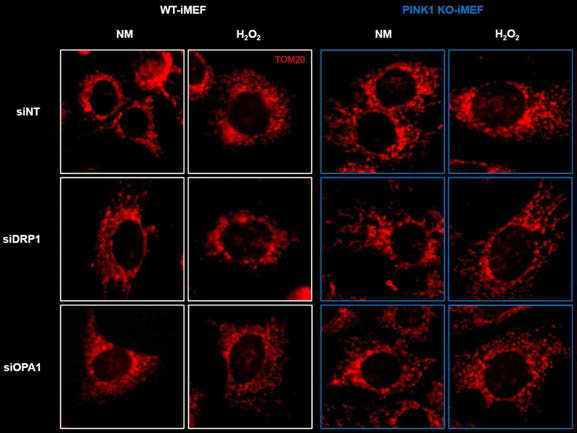 미토콘드리아 분열 (DRP1)과 융합 (OPA1) 유전자를 각각 녹다운 시켜 H2O2를 이용한 산화적 스트레스 하에서 미토콘드리아의 구조 변화 관찰. 정상 (WT-iMEF) 및 PINK1 녹아웃 (PINK1 KO-iMEF) 세포주에 siDRP1 또는 siOPA1을 이용해 녹다운 시킨 후 750 uM H2O2를 12시간 동안 처리한 후 TOM20 항체를 이용해 형광면역염색을 수행함