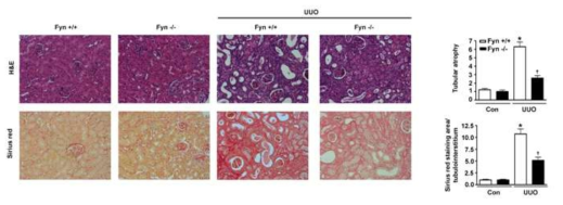 Fyn Knockout mice 에 일측성 요관폐색을 시행 후 섬유화 관찰
