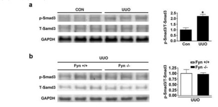 Fyn KO mice 에 UUO 를 시행시 Smad3 의 변화