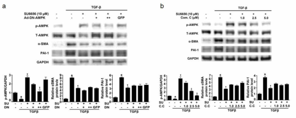 Fyn kinase 억제제 사용시 AMPK와 섬유화 인자의 변화