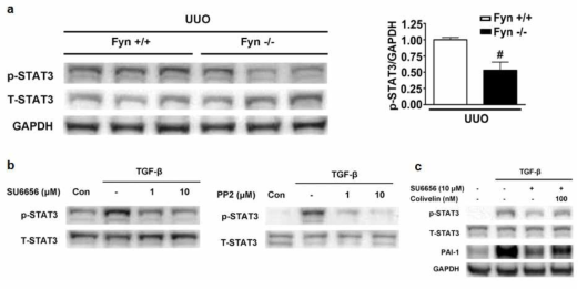 Fyn kinase 억제에 의한 신섬유화 기전에서 STAT3 변화