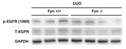 Fyn 억제시 EGFR 의 변화