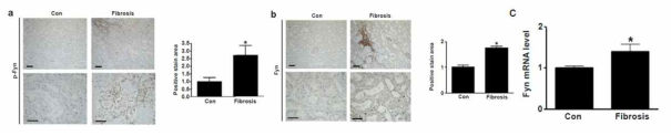 인간 신섬유화 조직에서 Fyn 발현