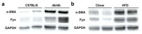 db/db mice와 고지방식이에서 Fyn 변화에 따른 섬유화인자의 변화