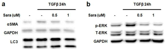 신섬유화 상태에 Fyn kinase 억제제인 Saracatinib을 처치하였을 때 섬유화 변화