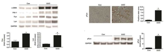 UUO 모델을 이용한 신섬유화와 Fyn 발현 확인