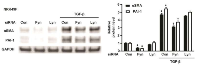 siRNA를 이용하여 Fyn 이 섬유화인자에 미치는 영향 확인