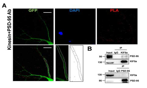 In vivo에서 상호작용의 확인 (A) PLA를 통한 상호작용의 확인 (B) IP를 통한 rat brain lysate에서 두 단백질의 상호작용 확인