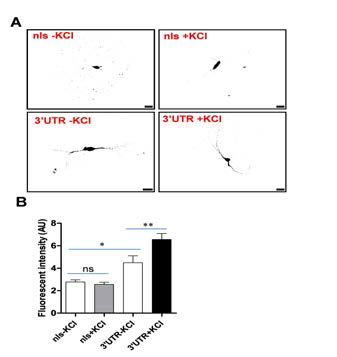 GFP-MS2 binding system을 이용하여 PSD-95 3‘UTR을 포함하는 RNP가 신경세포의 활성에 의해 가지 돌기로 이동이 증가함을 확인 하였다. (A) GFP-MS2 벡터가 발현된 신경세포의 대표적인 모습 (B) PSD-95 mRNA의 가지돌기로의 이동을 정량함