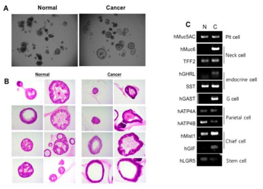 Human organoid (정상 및 암조직으로부터 유래된 organoid). A. 배양 10일째의 organoid. B. H7E stain. C. 수립된 organoid에서 발현되는 Gastric cell lineage markers 조사