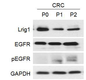 구축된 CRC에서 Lrig1 및 그와 관련한 단백질의 발현관찰