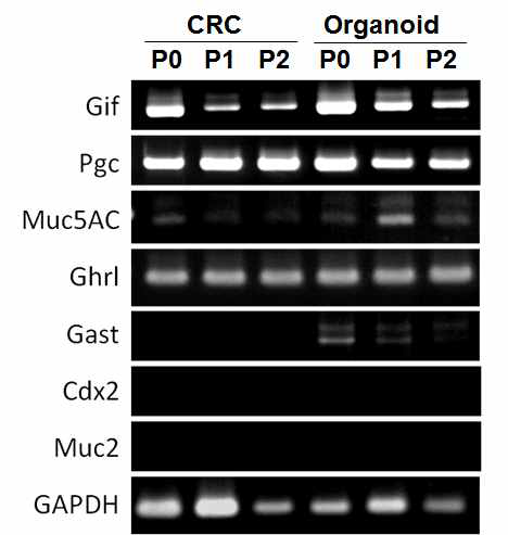 정상 위상피세포의 CRC 및 organoid에서gastric cell lineage marker 발현 확인