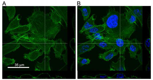 Fluorescence images of breast cancer cells showing actin filaments (green) and DAPI (blue) for nuclear counterstaining. The vertical slices corresponding to white lines are shown at the bottom and side of the images