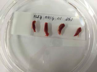 Choice of epoxy to fix the tissue sample on the glass substrate for the AFM measurements