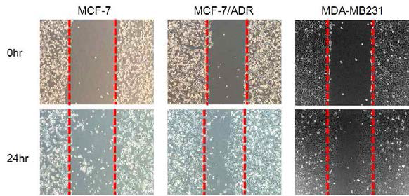 The cell motility measured by wound healing assay of breast cancer cells. The MCF-7/ADR and MDA-MB231 cells showed the increase in the cell motility compared to MCF-7 cells