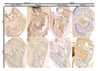 Apigenin 처리 군에서, Nestin 발현이 빠르게 일어나고, 염증을 나타내는 지표인 MPO 발현이 늦게 나타나는 것이 관찰됨. 이는 초기 염증반응을 억제하여 dentin 치유가 빠르게 일어날 수 있게 하는 것으로 추정되며, 추가적인 연구가 필요함