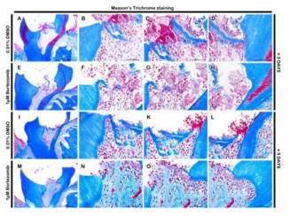 Masson's trichrome staining in pulp and dentin of upper molar with method after 3 days (A to H), and 5 days (I to P). After 3 days, no obvious differences was observed between control and experimental specimens in morphological aspects. the experimental group showed more numbers of blood vessel structures and heterochromatin staining pattern of nucleus within the adjacent cells to the dentin wall when compared with the control group (B to D, F to H). After 5 days pulpal and dentinal tissues showed the not much altered to 3 days specimens in control group (I to L). 1 μM bortezomib treated specimen showed the functional blood vessel structures with blood cells and more stabilized cell and tissue conditions with well arranged collagen bundles in the pulp and heterochromatin staining patterns in adjacent cells to the dentin wall (M to P)