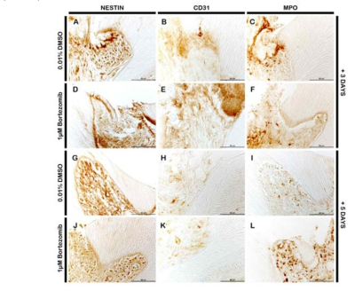 Immunolocalization patterns against the Nestin, CD31, and MPO were examined after 3 (A to F) and 5 days (G to L) from the cavity preparation. Localization pattern of Nestin, as a biological indicator for active odontoblast, was examined after 3 and 5 days after the cavity preparation (A, D, G, and H). After the treatment of bortezomib, strong Nestin positive reaction cells were detected along with the dentin wall at 3 day from cavity preparation but at 5 day, bortezomib treated specimen showed the decreased number of Nestin positive cells when compared with the control (D and J). CD31, also known as PECAM and a well known marker for endothelial cells, localization pattern was also examined (B, E, H, and K). In bortezomib treated group showed the strong positive reaction against the CD31 at 3 day, meanwhile control group showed the positive reaction at 5 day (E and K). We also examined the MPO for evaluation of inflammation level in the pulpal cells after the cavity preparation (C, F, I, and L). MPO positive cells were mainly examined at 3 day after the bortezomib treatment and 5 day in the control group(F and L)